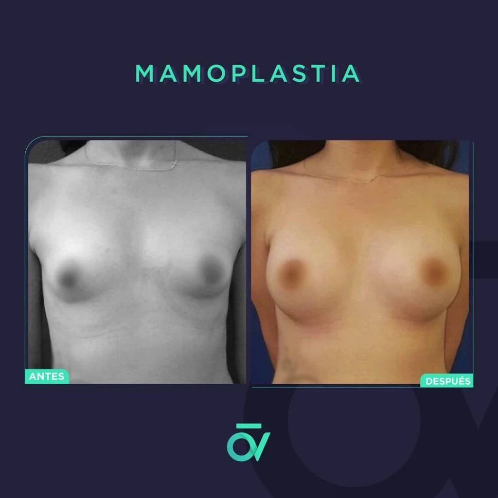 Oñate Valdivieso Plastic Aesthetic and Reconstructive Surgery - Image 6