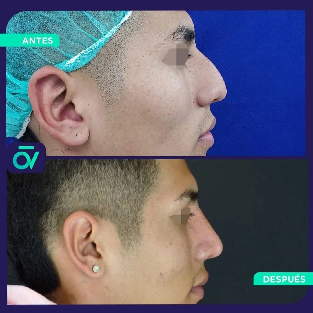 Oñate Valdivieso Plastic Aesthetic and Reconstructive Surgery - Image 2