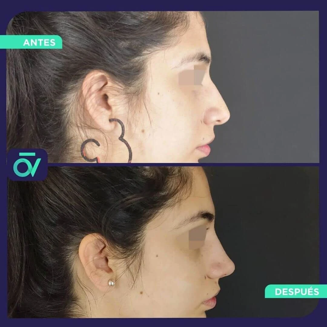 Oñate Valdivieso Plastic Aesthetic and Reconstructive Surgery - Image 1
