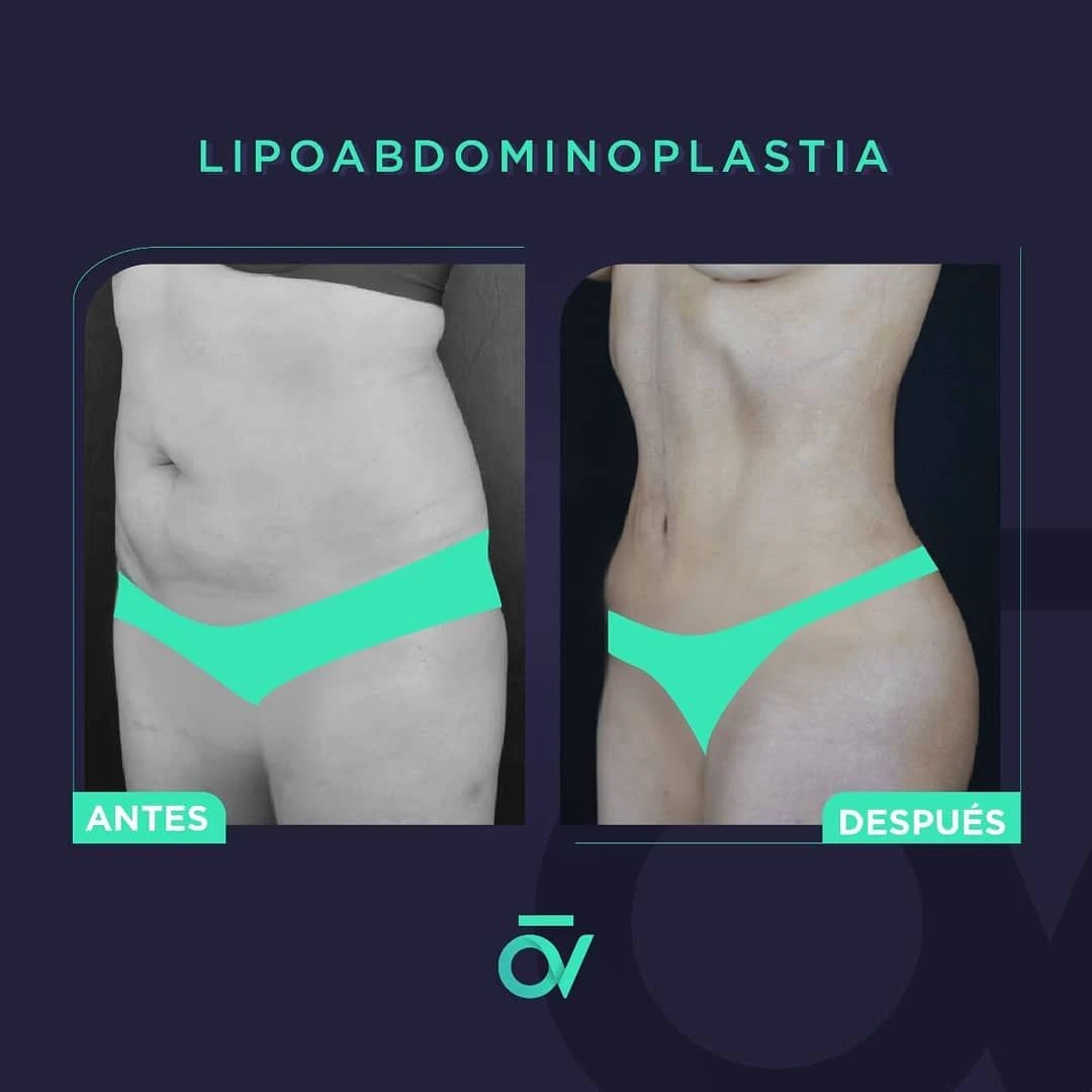 Oñate Valdivieso Plastic Aesthetic and Reconstructive Surgery - Image 3