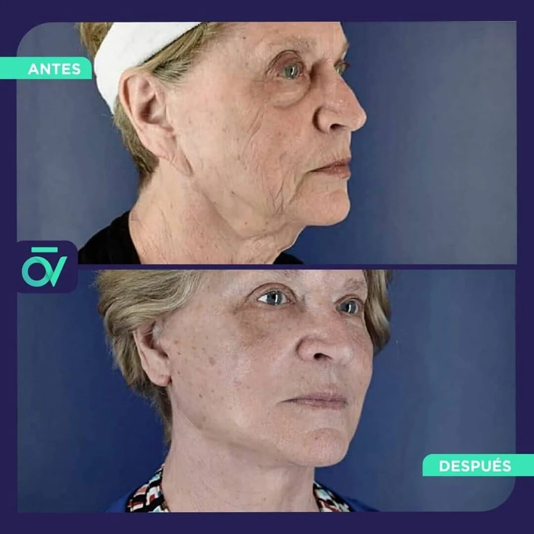Oñate Valdivieso Plastic Aesthetic and Reconstructive Surgery - Image 4