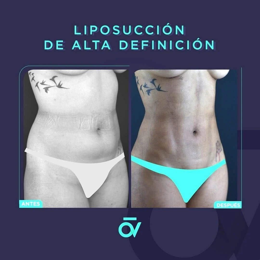 Oñate Valdivieso Plastic Aesthetic and Reconstructive Surgery - Image 5